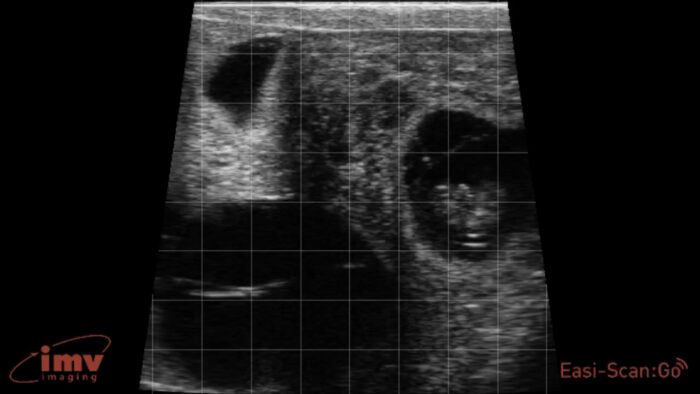 Pregnancy Diagnosis Scanning